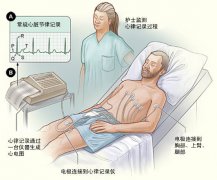 冠心病需要做哪些檢查？