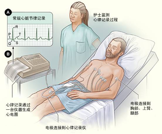冠心病需要做哪些檢查？(圖1)